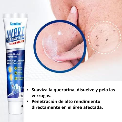 WART REMOVER™ ⭐⭐⭐⭐⭐ TRATAMIENTO PARA VERRUGA Y MACHAS